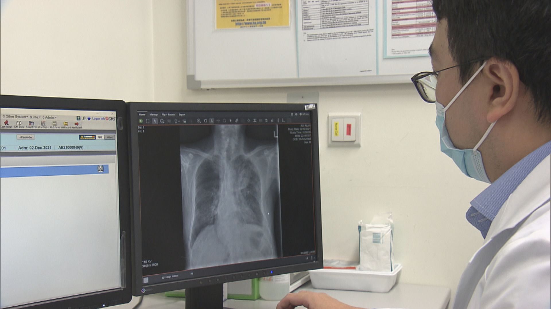 公立醫院急症室引入人工智能系統協助辨別肺片有陰影病人
