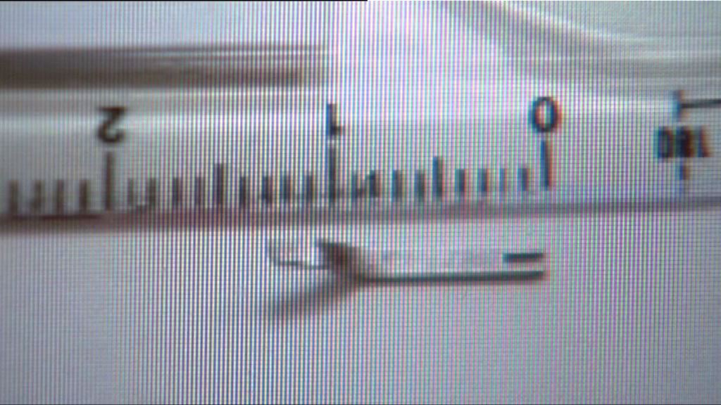 《風險通報》：手術儀器碎片遺留體內