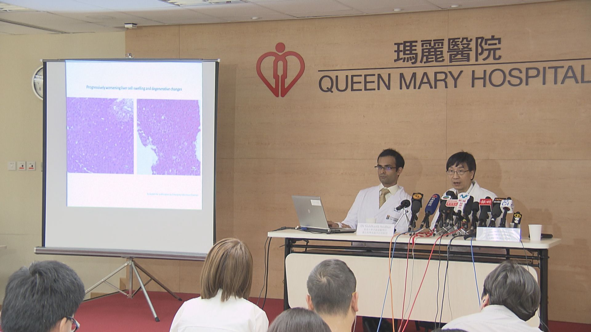 本港再發現一宗老鼠傳人戊型肝炎