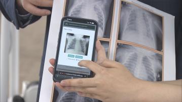港大醫學院新增AI課程 增學生臨床診症經驗