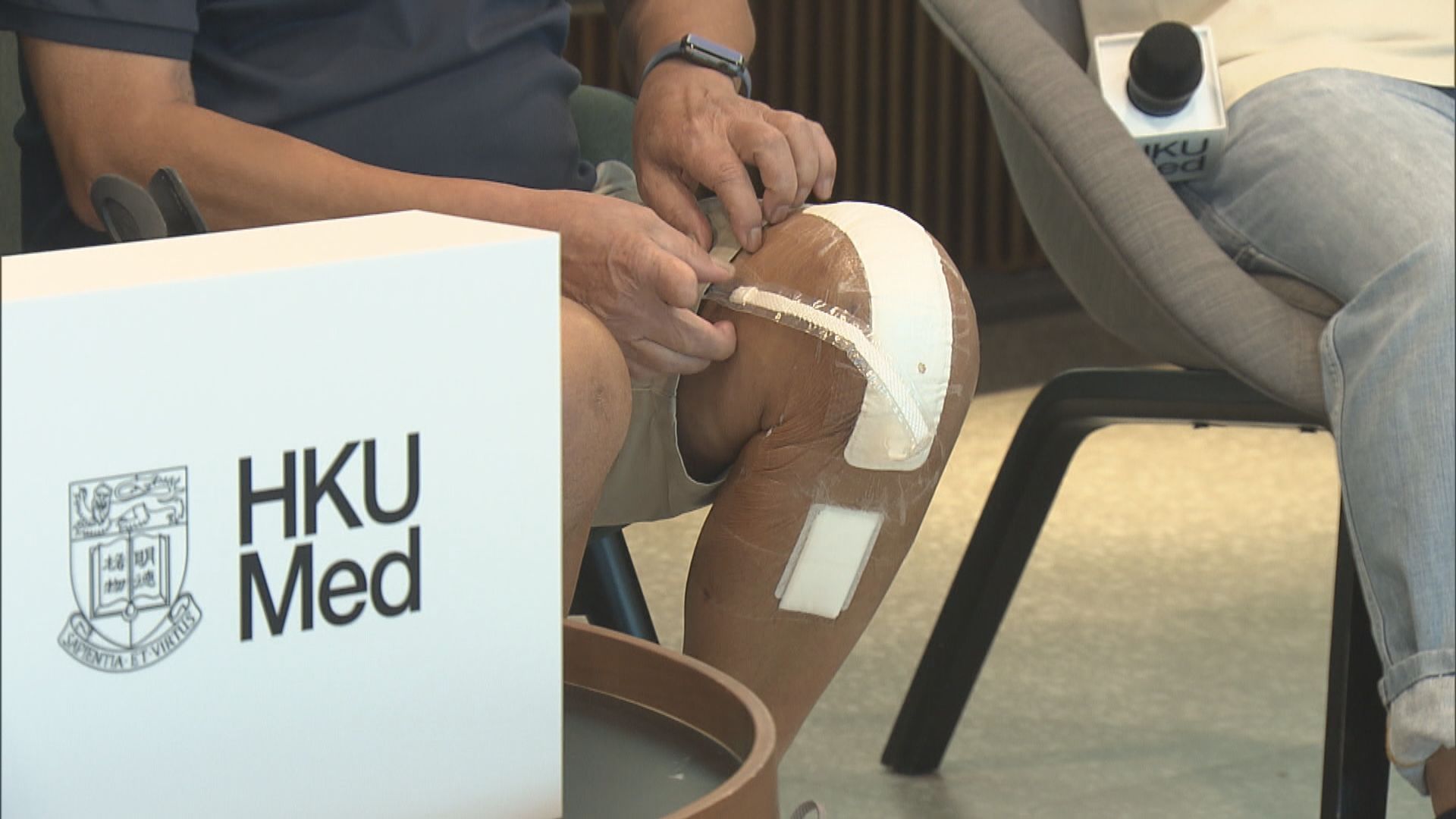 港大醫學院新技術助減輕換膝後痛楚