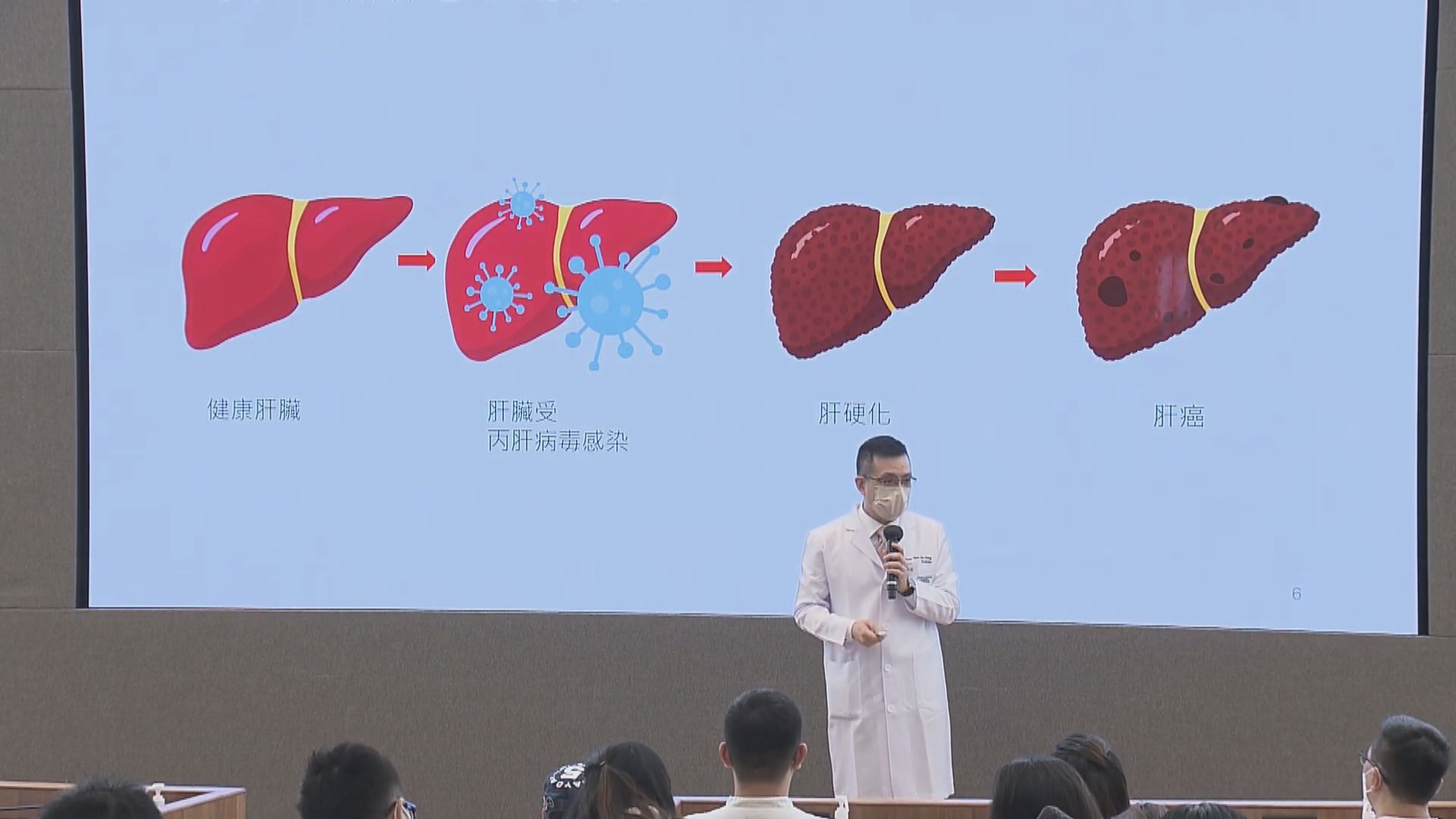 港大醫學院丙型肝炎篩檢　從高危群組找出逾百名患者