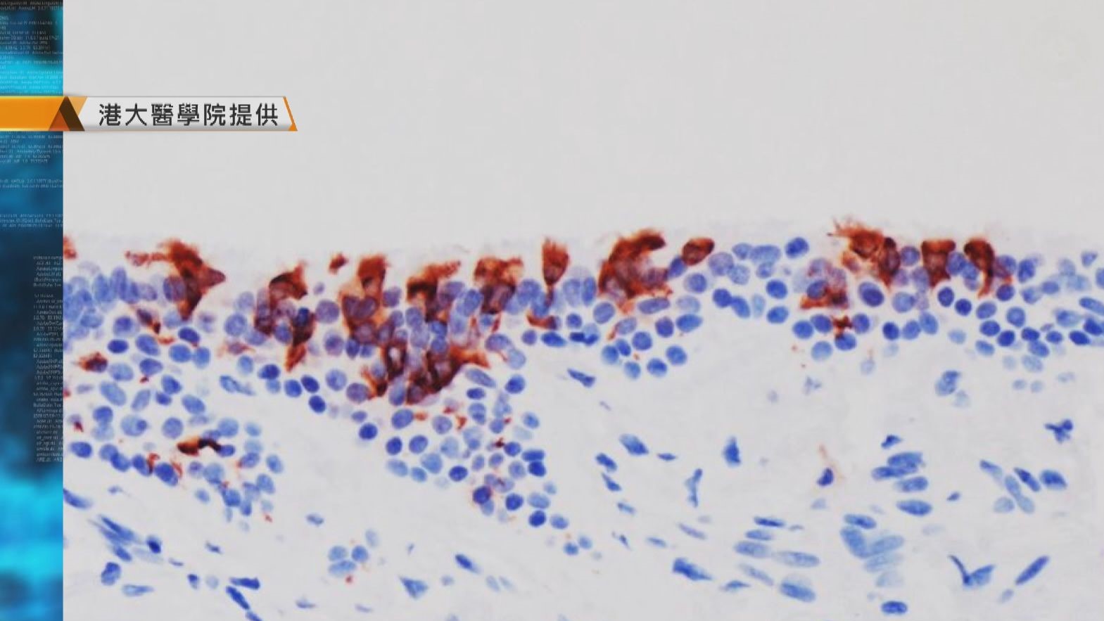 本港增一宗Omicron　港大研究反映傳播力高而致病程度弱