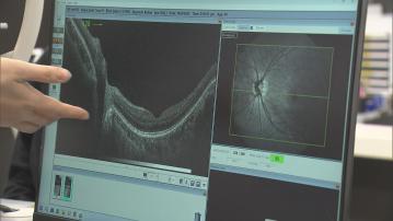 港大推人工智能光學掃描系統早及識別視神經退化　冀縮短專科門診輪候時間