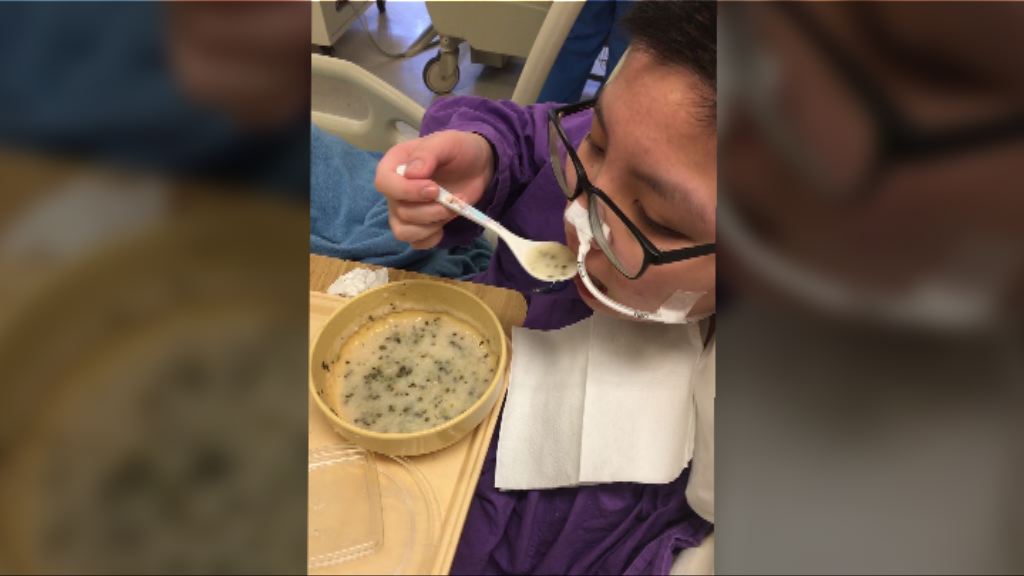 少女手術致中風家屬質疑院方沒清楚交代風險