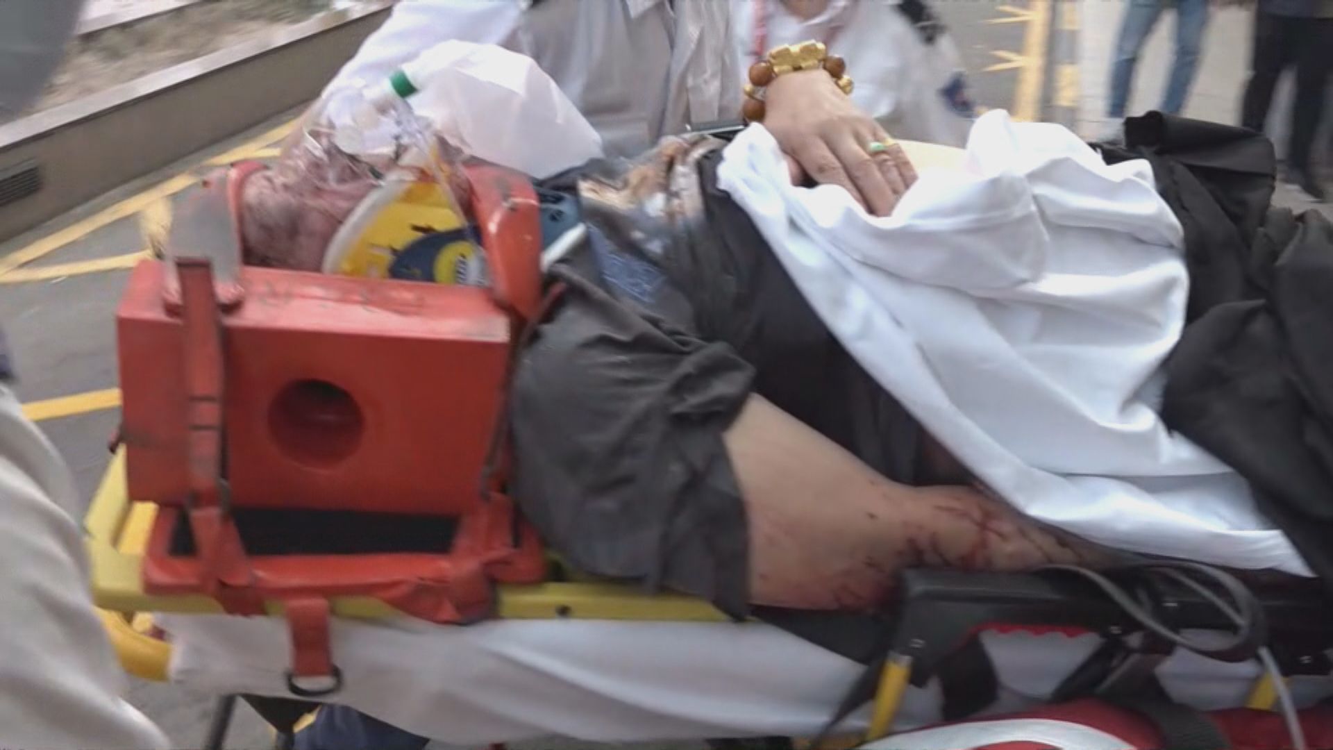 北大嶼山翔東路校巴與巴士相撞 三十多人傷