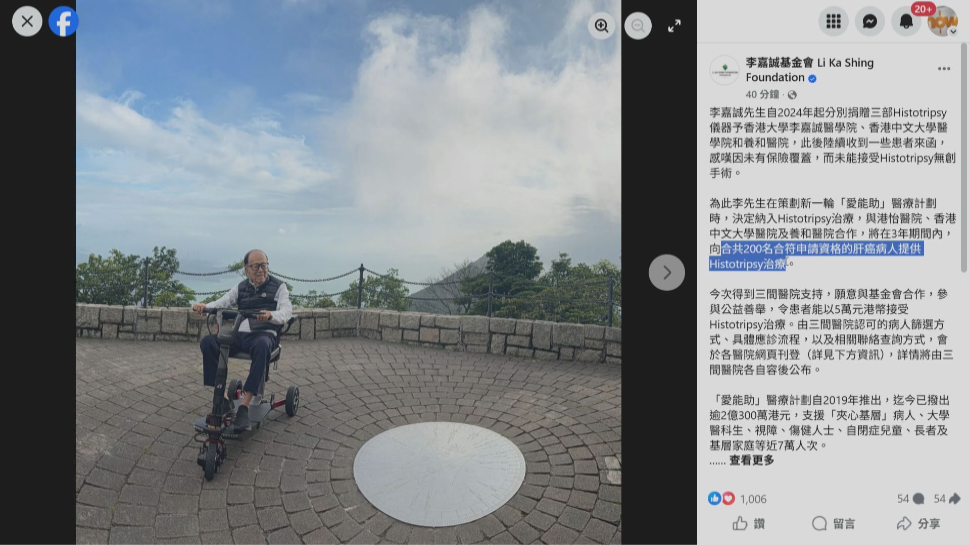 李嘉誠基金會資助200名肝癌患者接受Histotripsy組織碎化技術無創手術