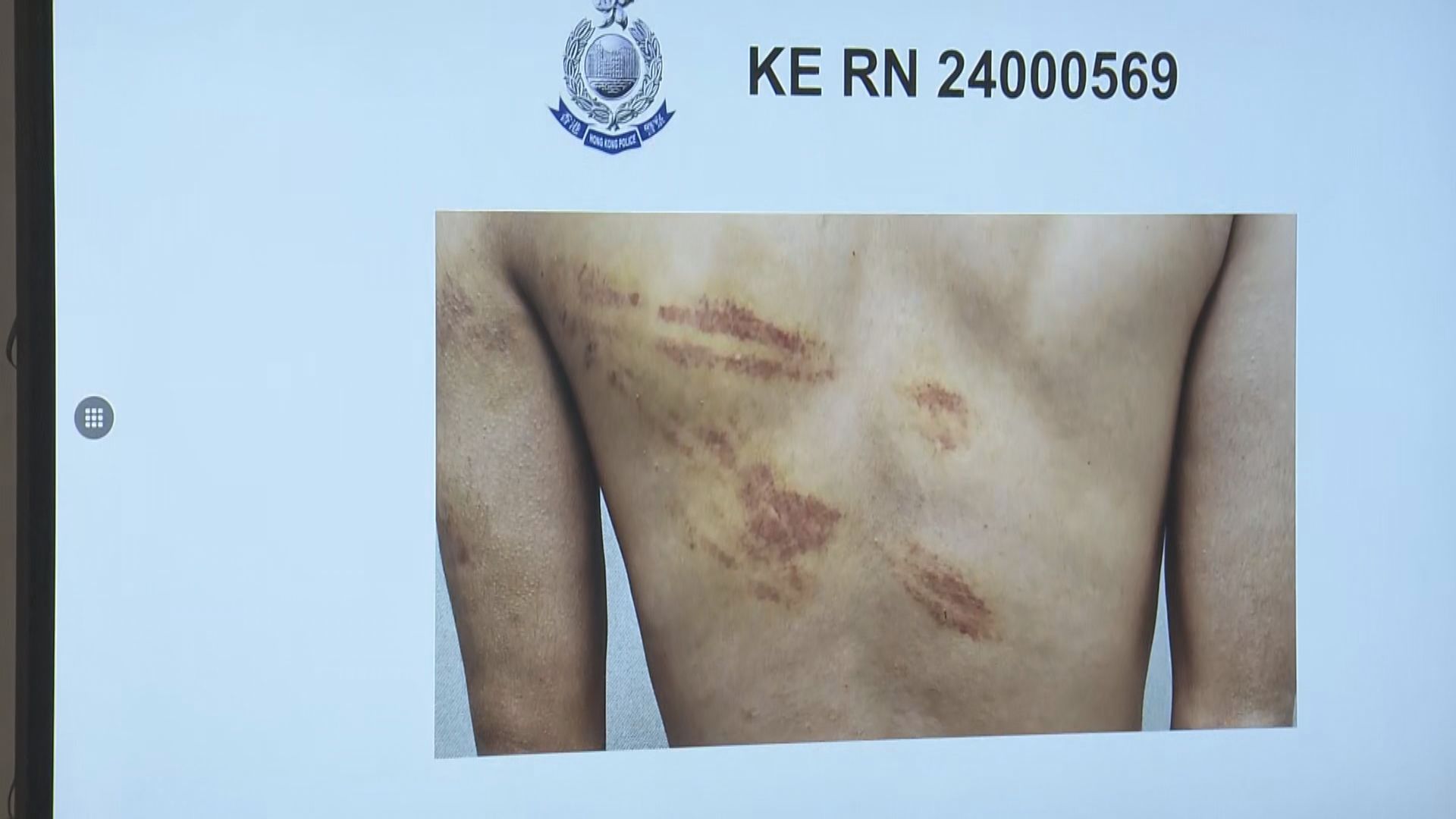 緬甸園區港人詐騙款項未達標　被毒打及扣起膳食