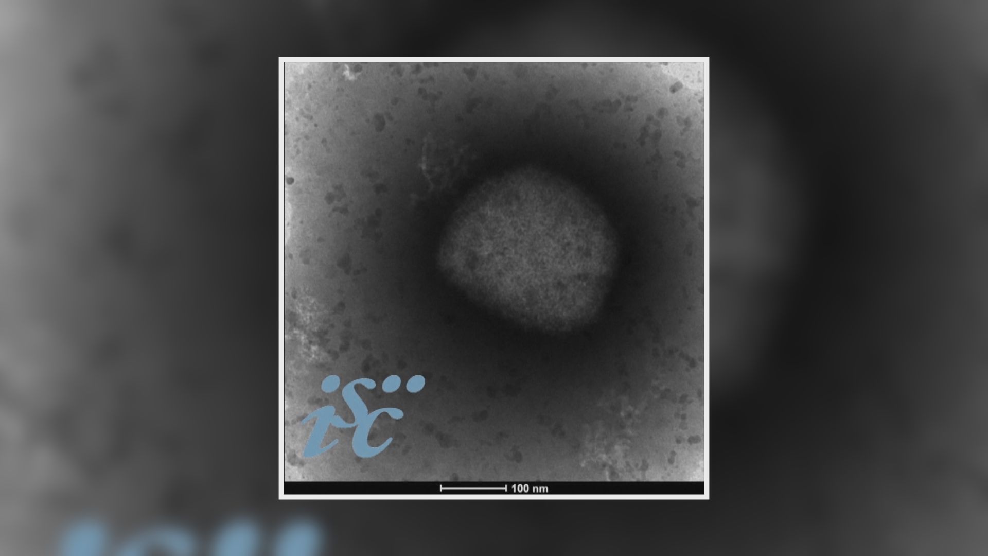 世衛憂猴痘病毒傳播至孕婦等高危人士