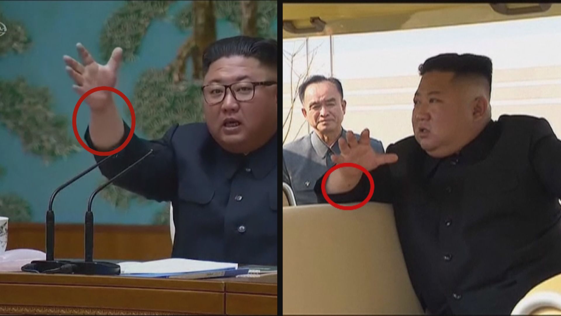 南韓總統府官員：金正恩無動過任何手術