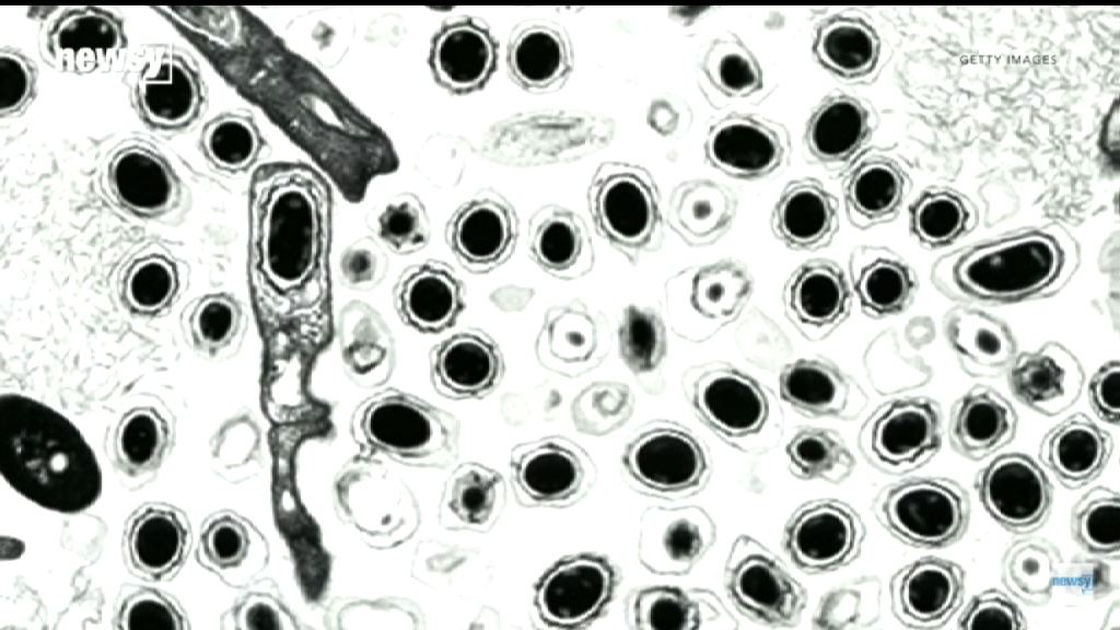 北韓據報正研發炭疽菌武器