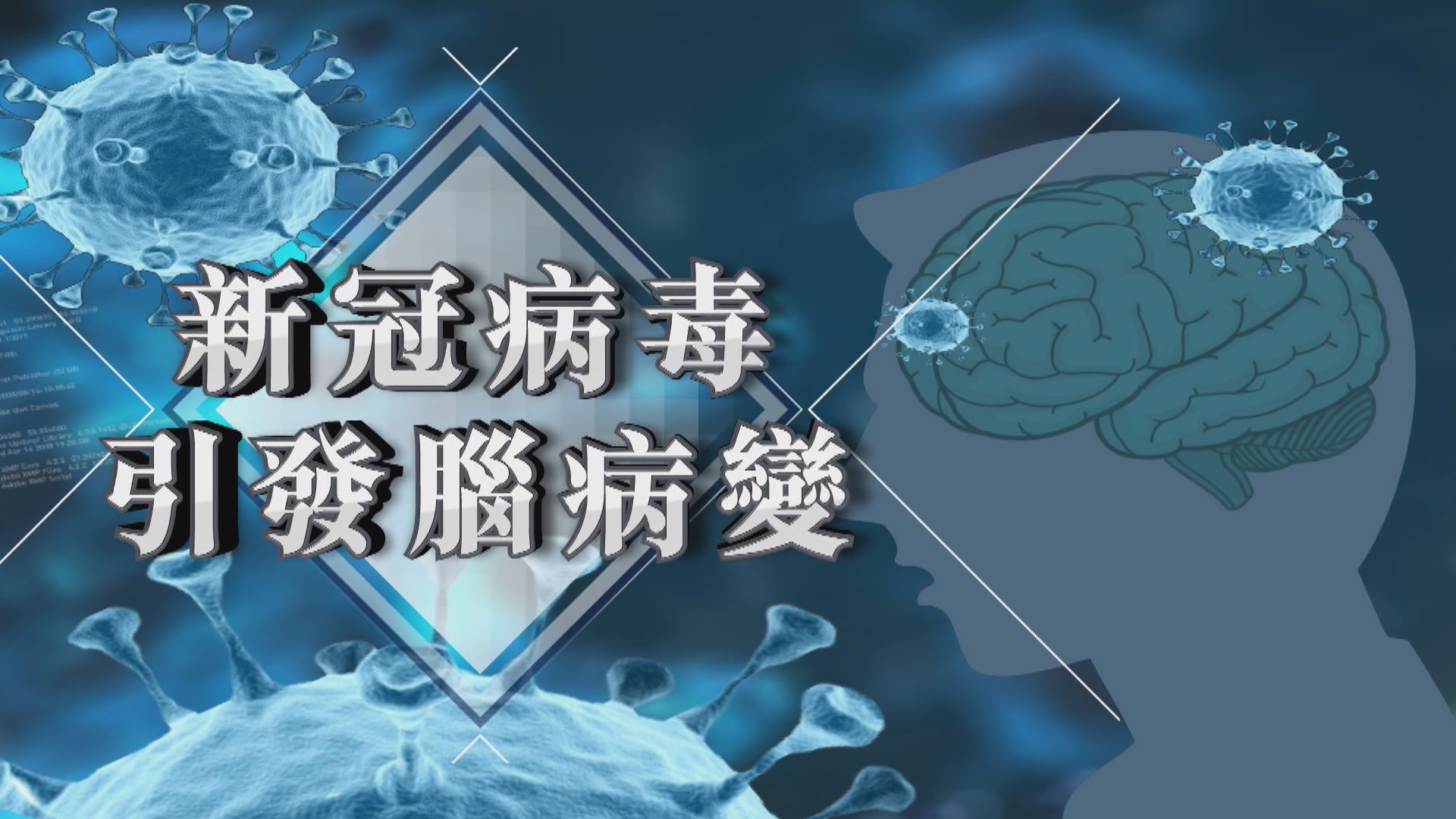 【新聞智庫】新冠病毒引發腦病變