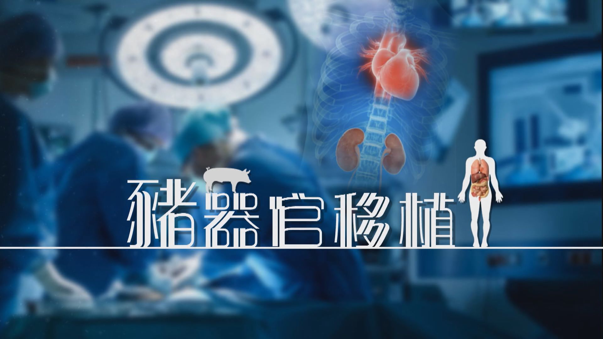 【新聞智庫】豬器官移植