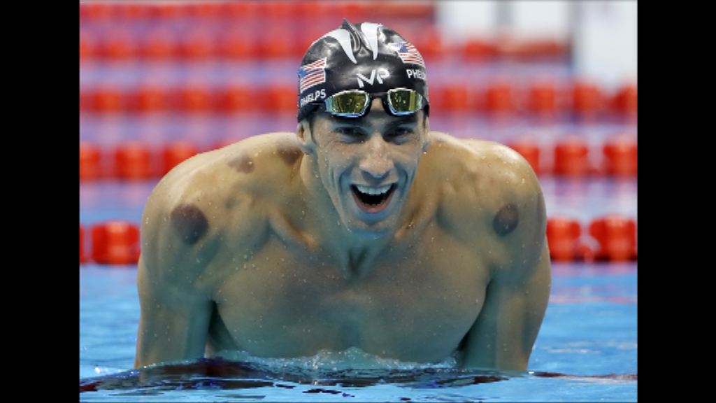 菲比斯輝煌背後曾陷入低谷