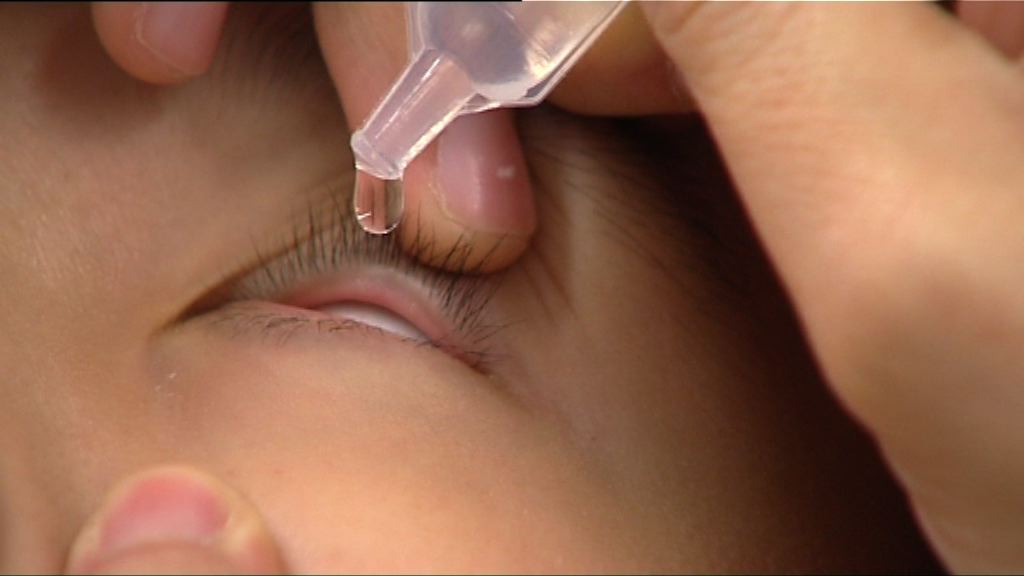 【杏林在線】減慢近視加深眼藥水