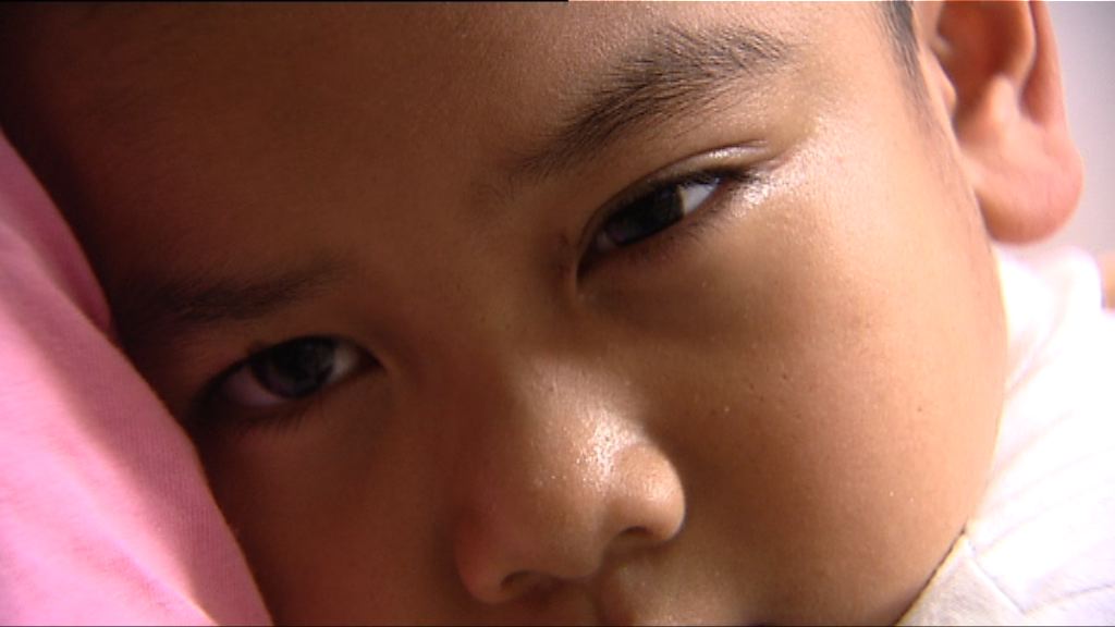 【杏林在線】兒童眼癌