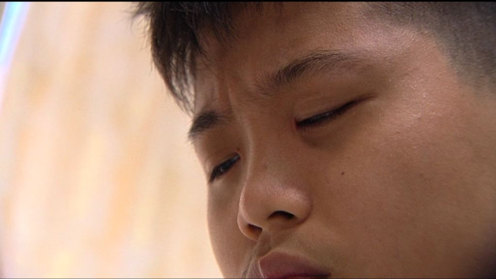 【杏林在線】錐形角膜