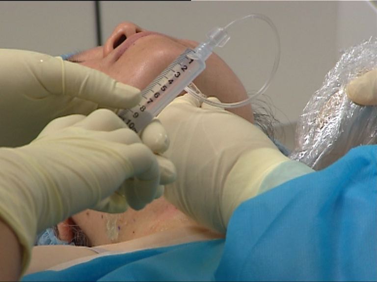 【杏林在線】良性甲狀腺結節治療