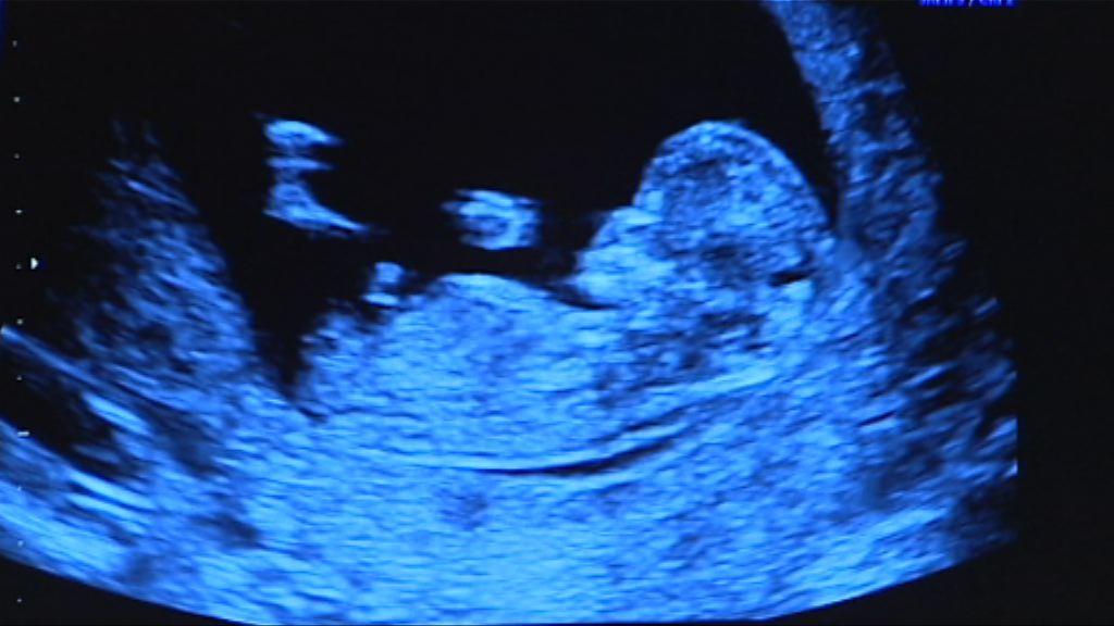 【杏林在線】墮胎之後