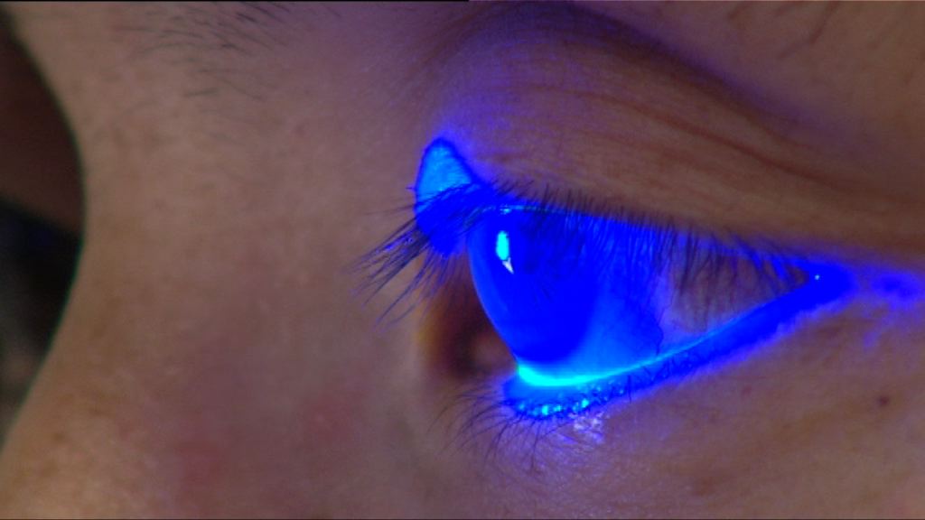 【杏林在線】眼睛檢查防眼疾