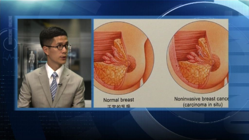 【杏林在線】針灸紓緩乳癌化療影響