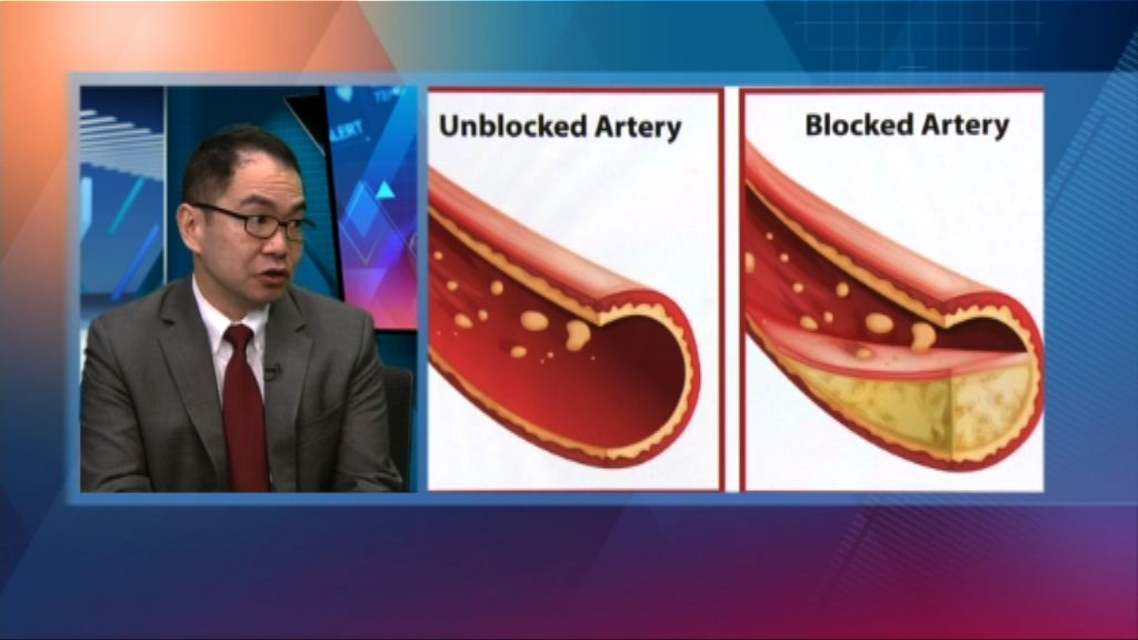 【杏林在線】家族性高膽固醇