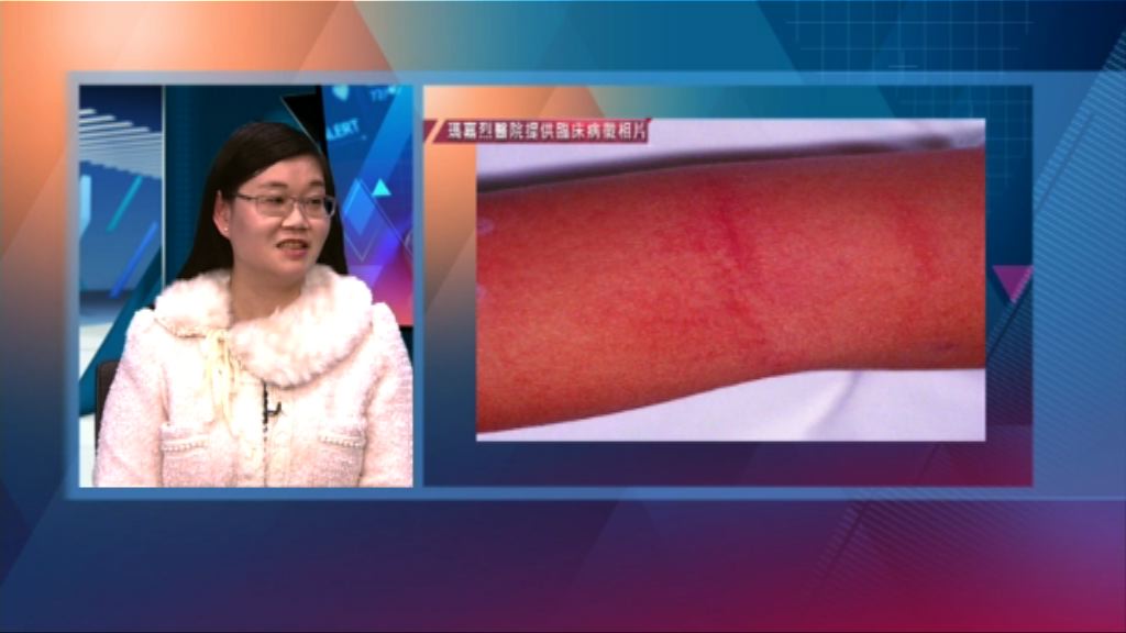 【杏林在線】猩紅熱