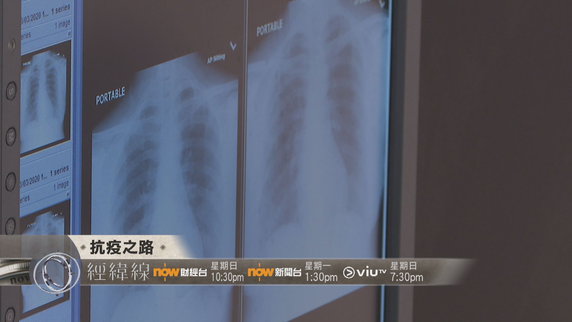 【經緯線本周提要】抗疫路上