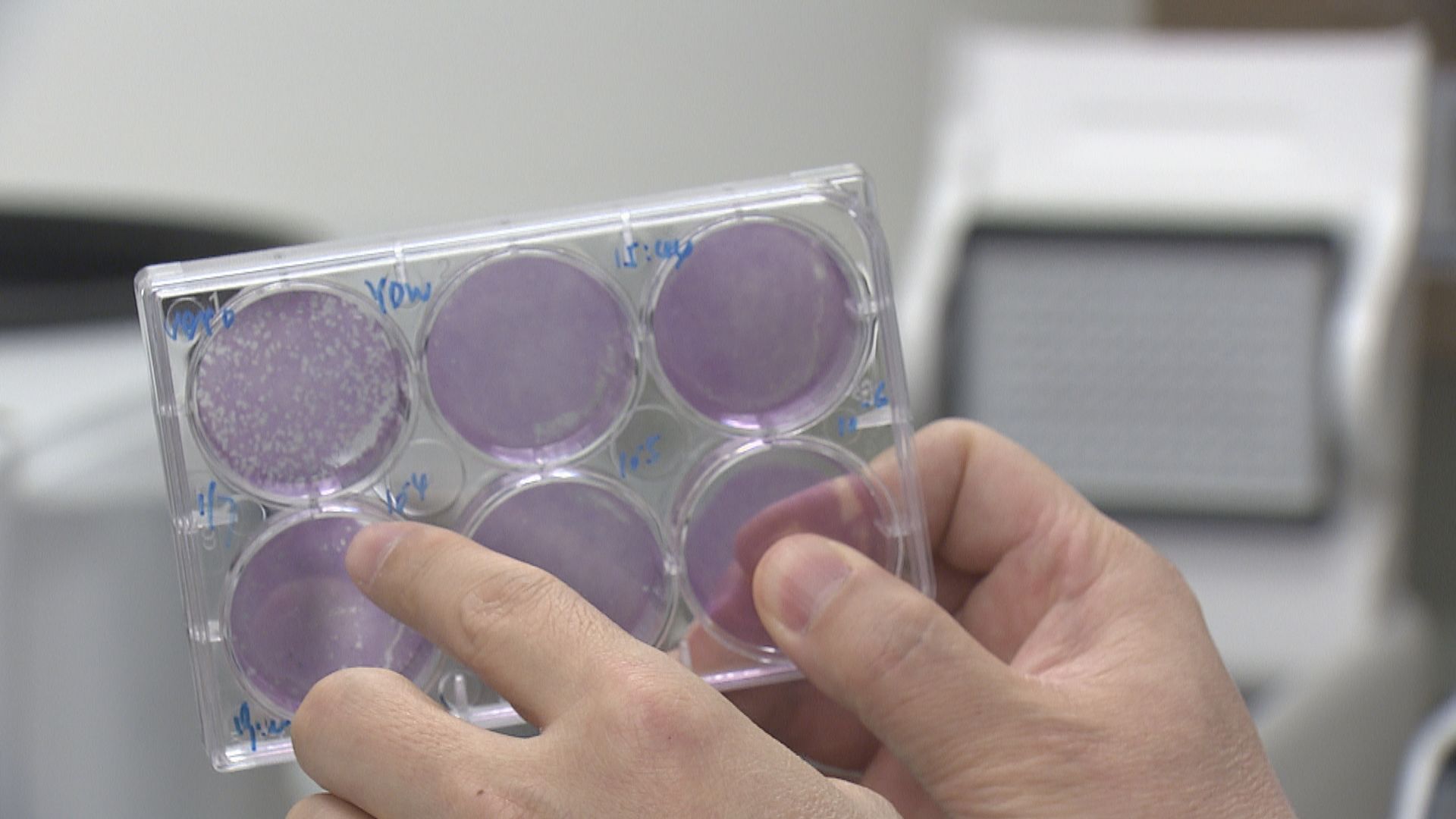 【經緯線】與病毒對弈（二）