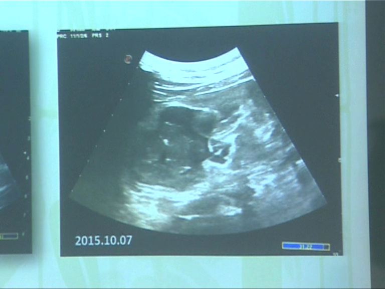 大熊貓盈盈流產　胎兒被母體吸收