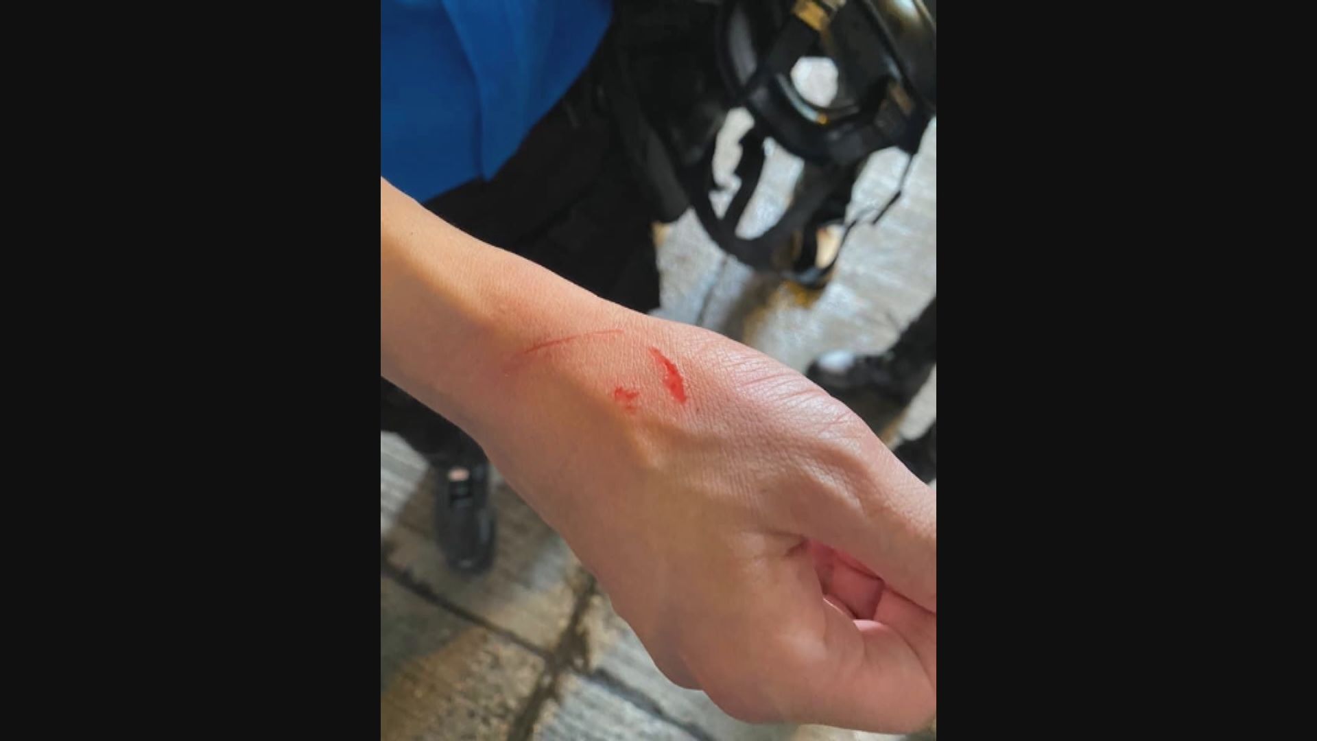 警方指至少五名警員在驅散行動期間遇襲受傷