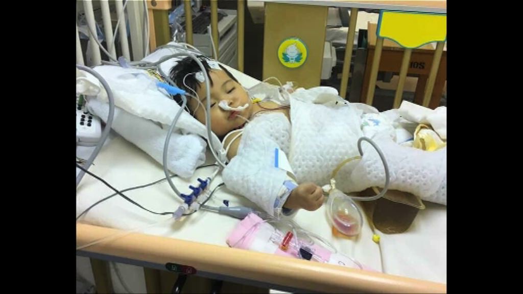 女嬰瑪麗手術後昏迷情況仍嚴重