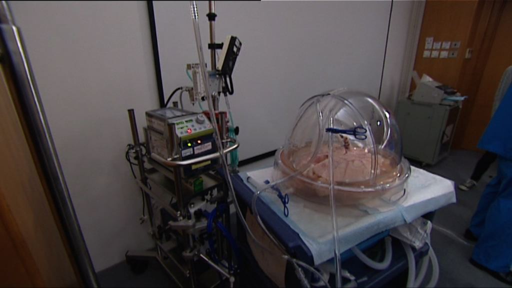 離體肺灌注有望增加可移植屍肺