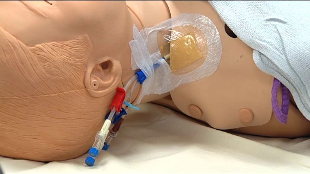 瑪麗護士疑拔除導管程序出錯