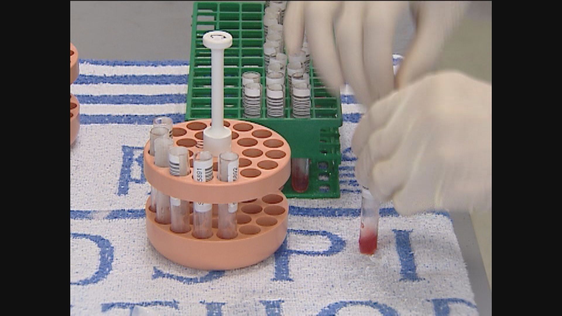 何栢良：除鼻咽樣本亦應化驗患者糞便
