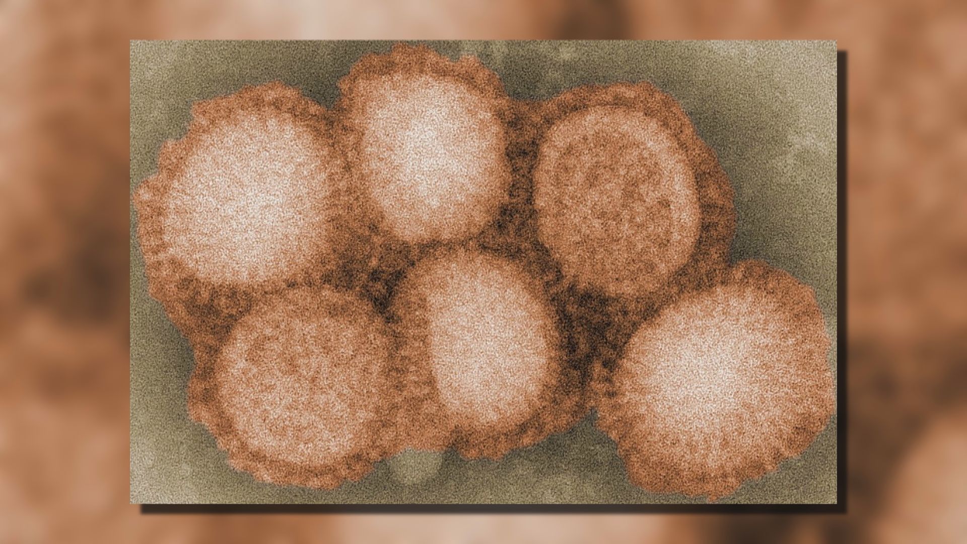 俄羅斯發現全球首批人類感染H5N8禽流感病例