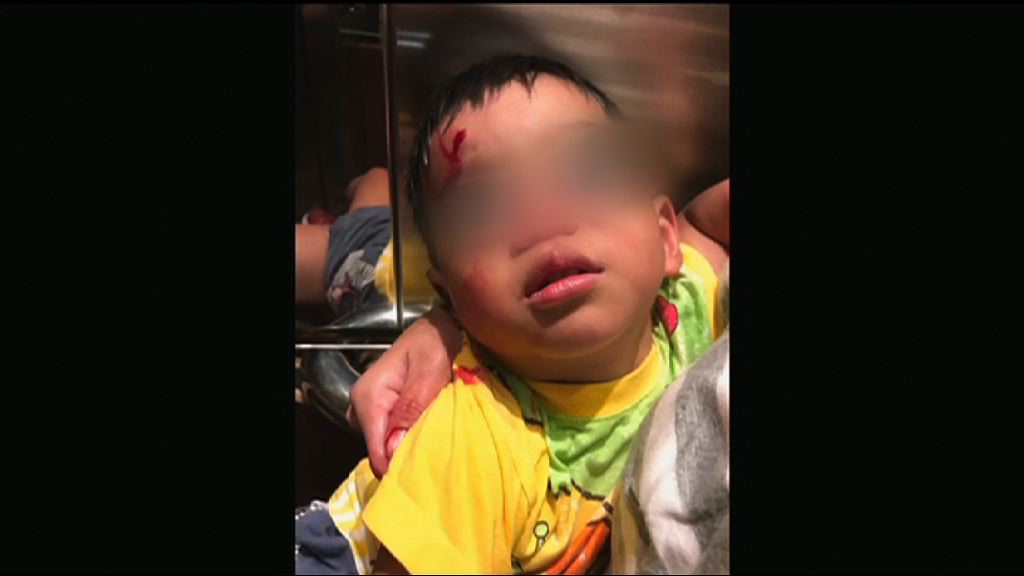 兩歲男童疑被氣槍射傷　重案組跟進