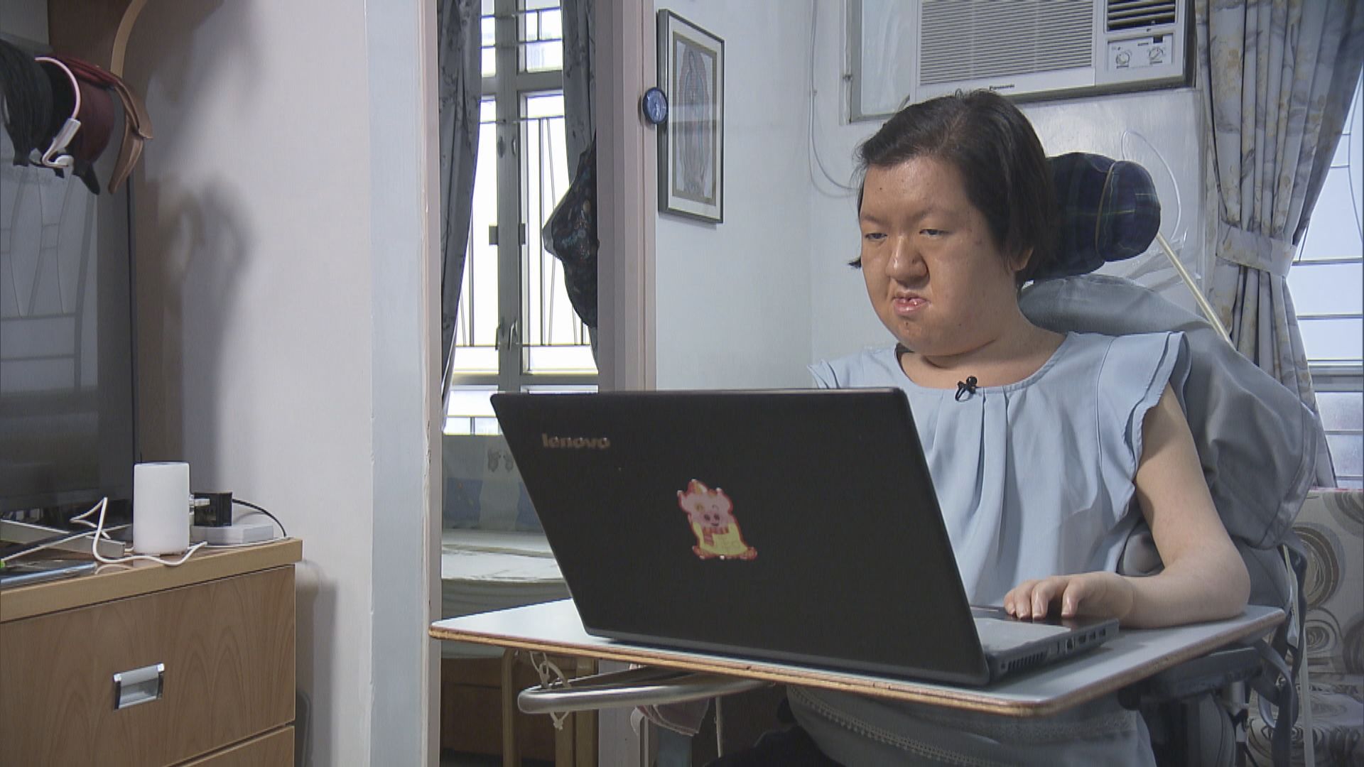 有脊髓肌肉萎縮症患者冀綜援與醫療津貼勿綑綁　鼓勵病患者工作