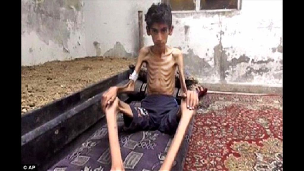 敘利亞四十萬無辜民眾孤立無援