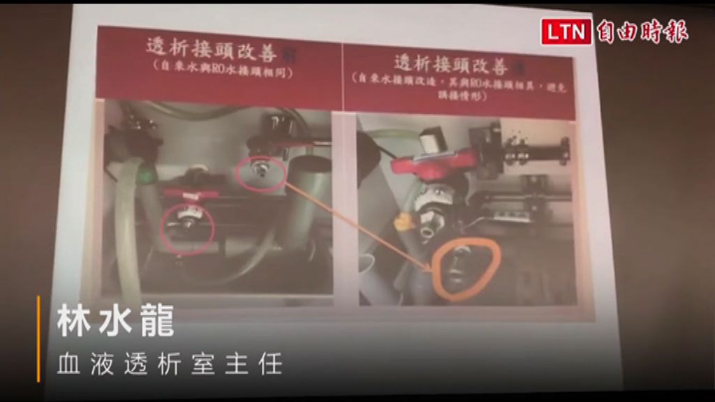 台大醫院為洗腎設備接錯喉管道歉