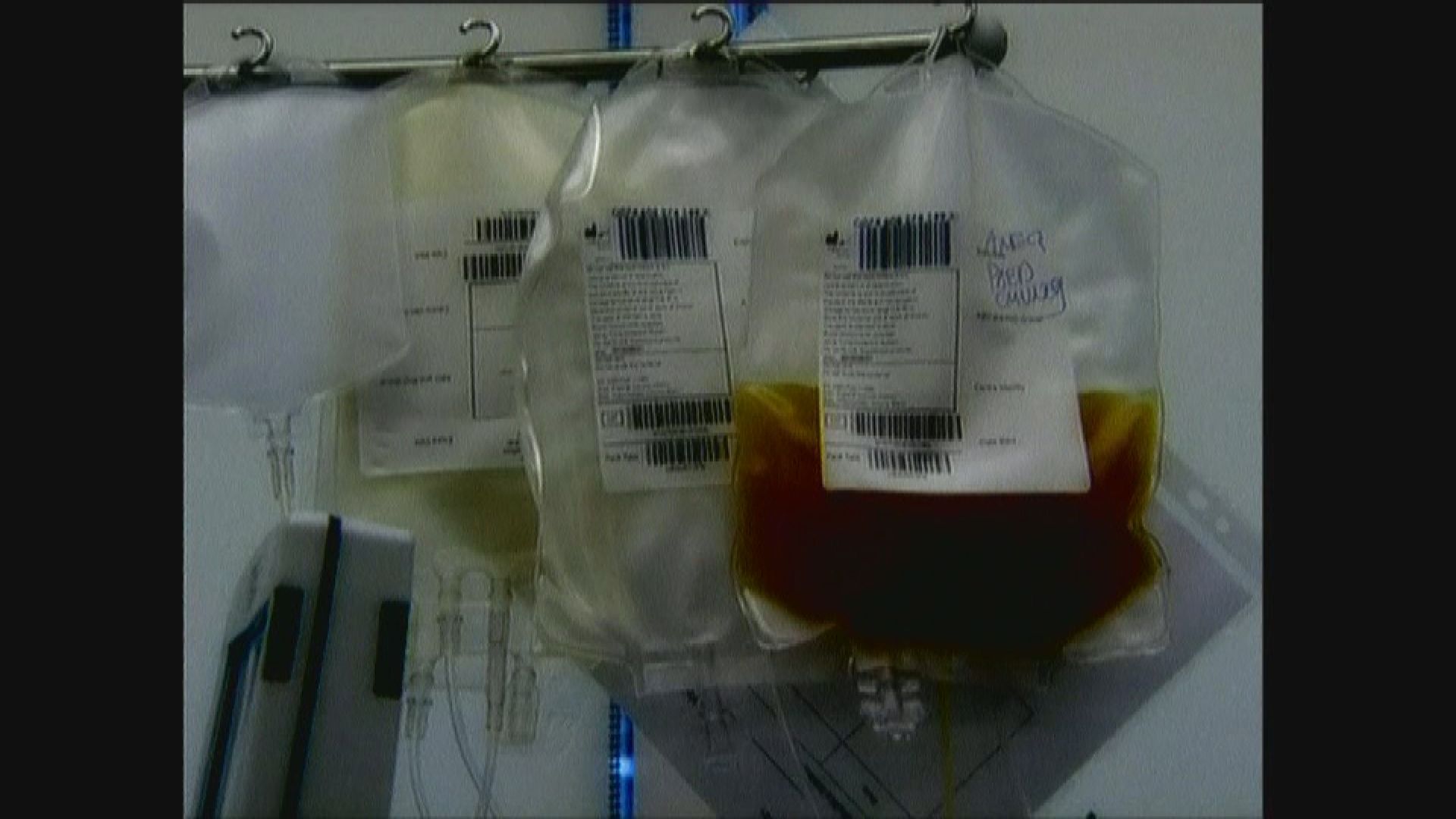 上世紀英國逾三千人因使用污染血漿死亡 調查報告下月出爐