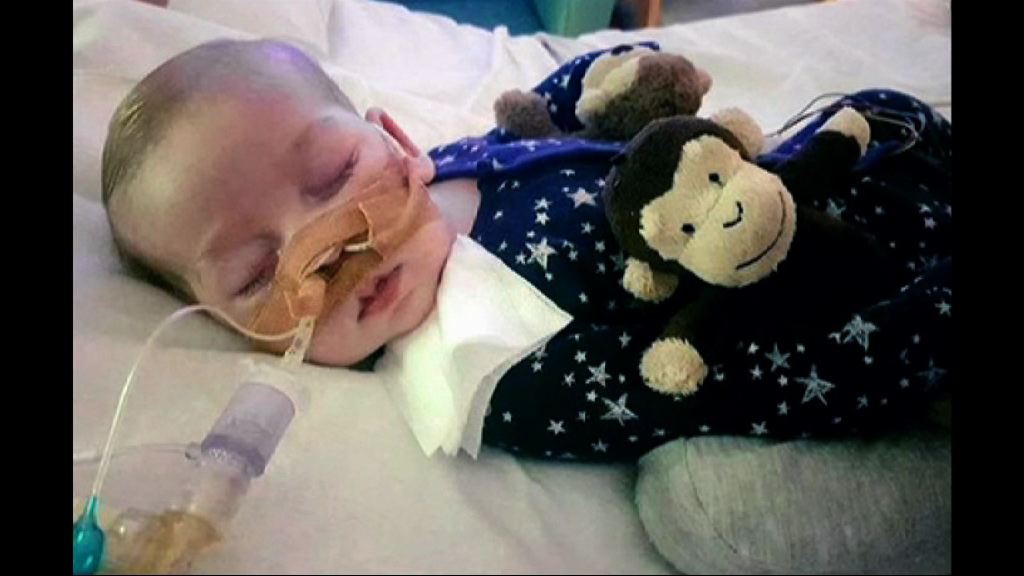 英國父母冀帶患遺傳病兒子返家