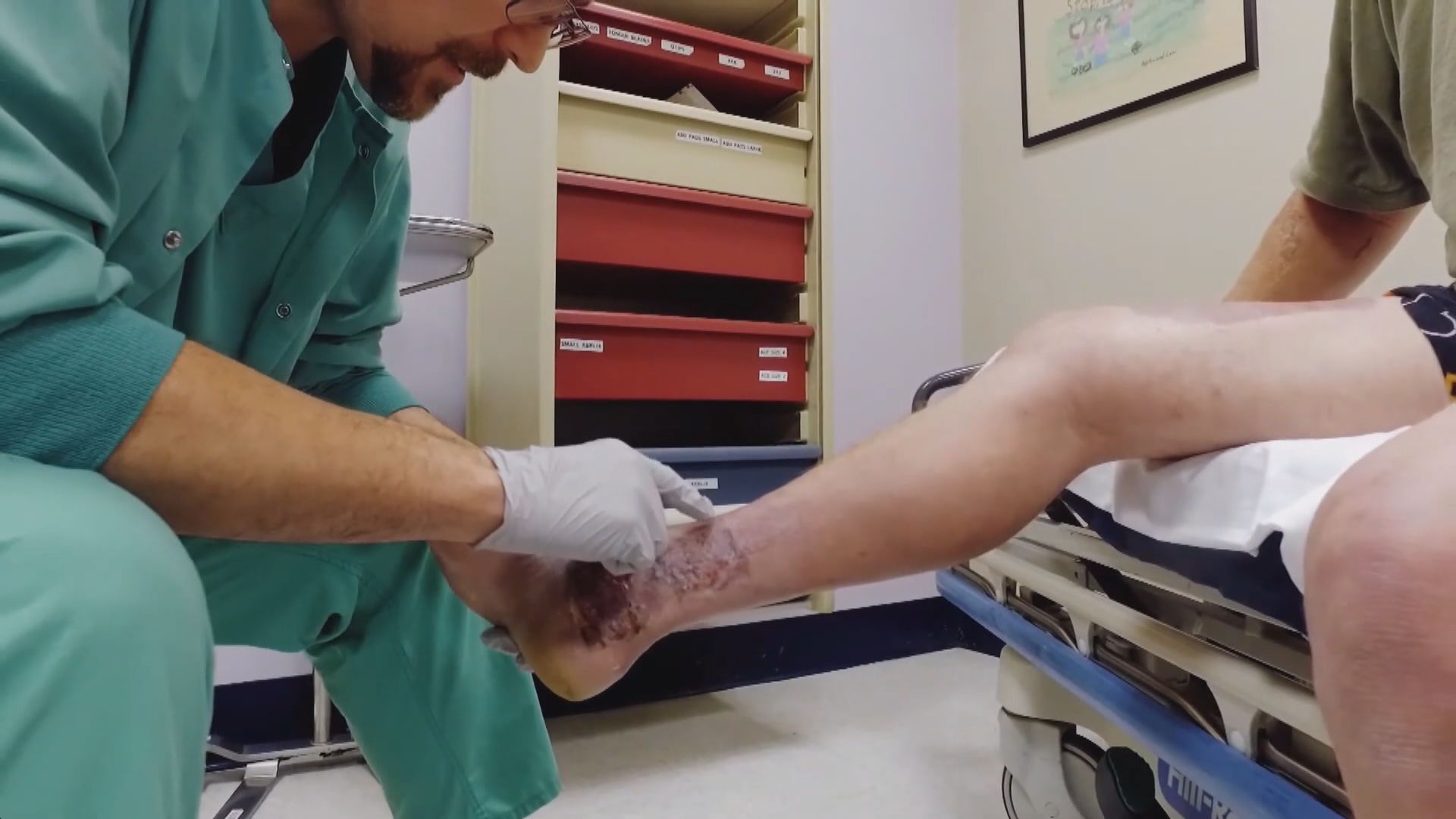 美國熱浪持續 觸碰極熱物料灼傷人數急增