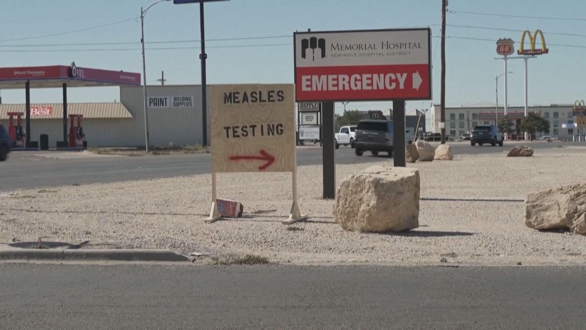 美國夏威夷1名未足五歲幼兒染麻疹