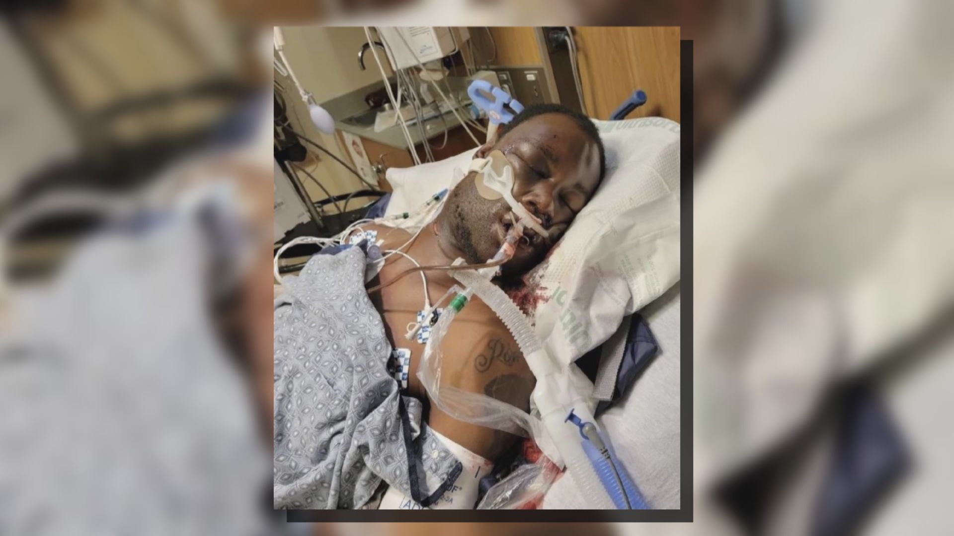 美黑人男子遭制服後傷重送院不治　涉事警員被控二級謀殺等罪