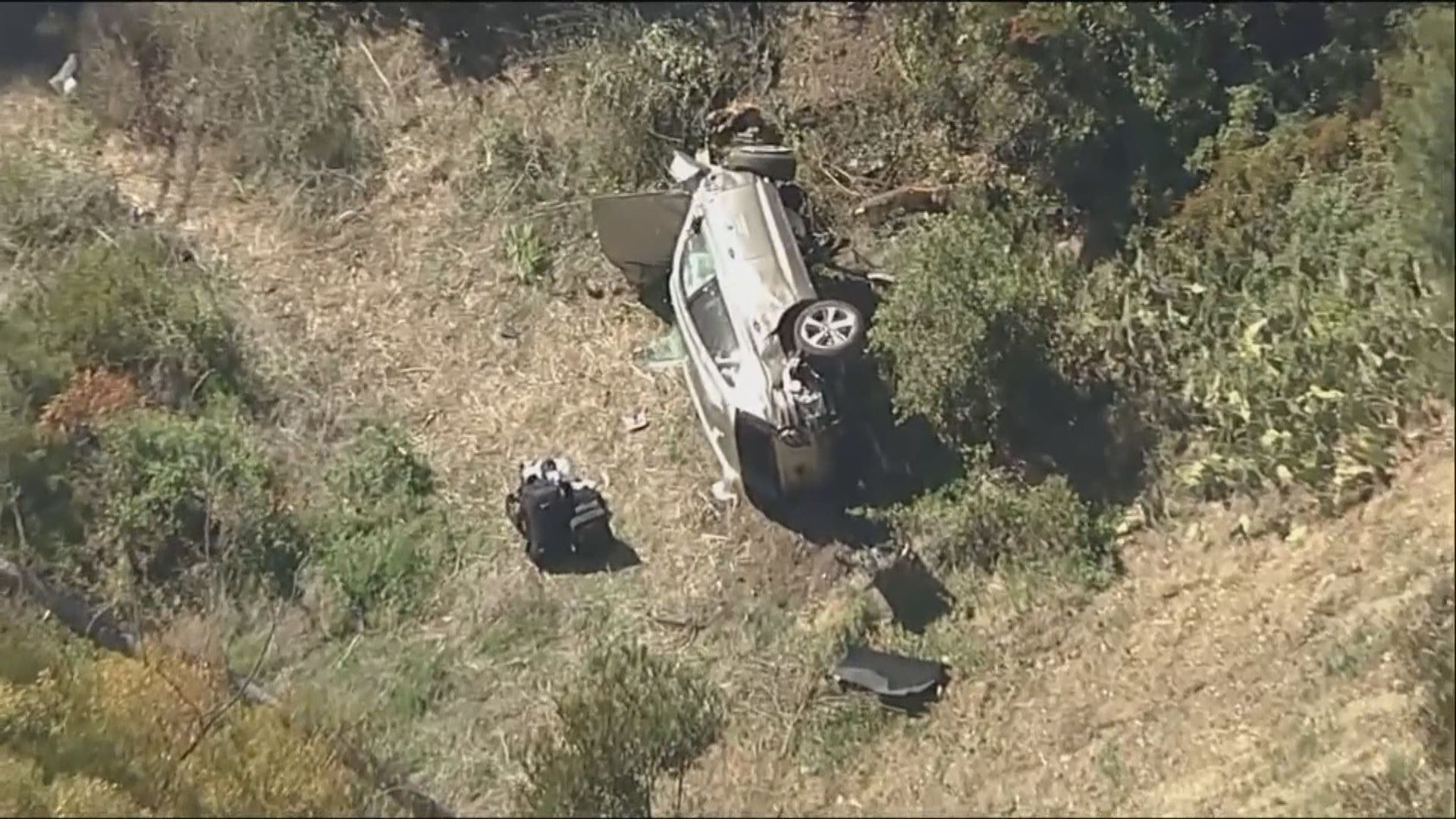 老虎活士加州遇車禍　腿部多處受傷送院接受手術