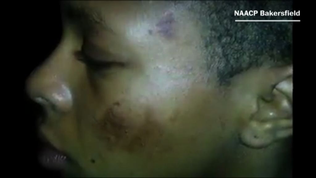 加州少女遭警暴力對待要求賠償