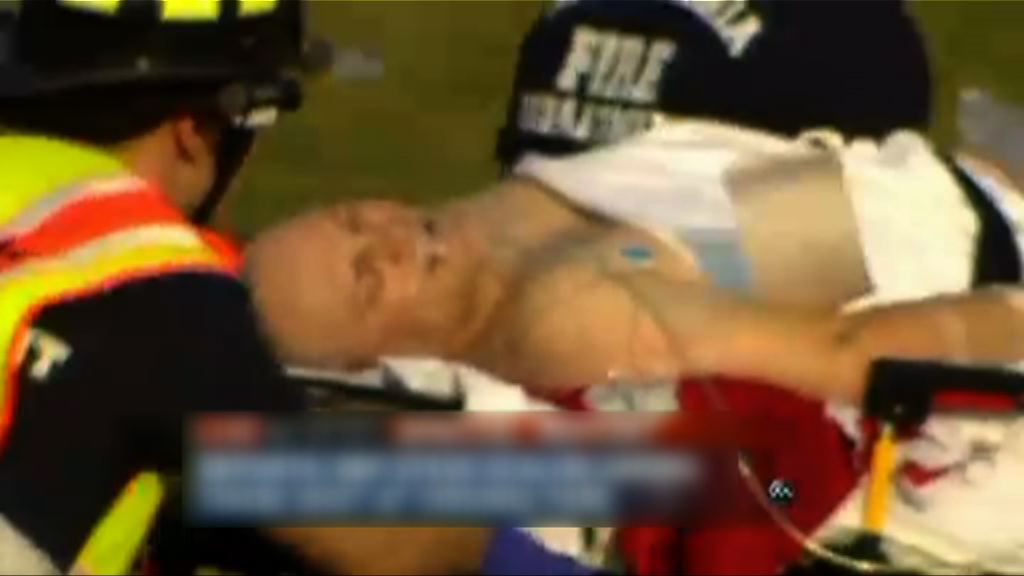 美國共和黨眾議員棒球場中槍受傷