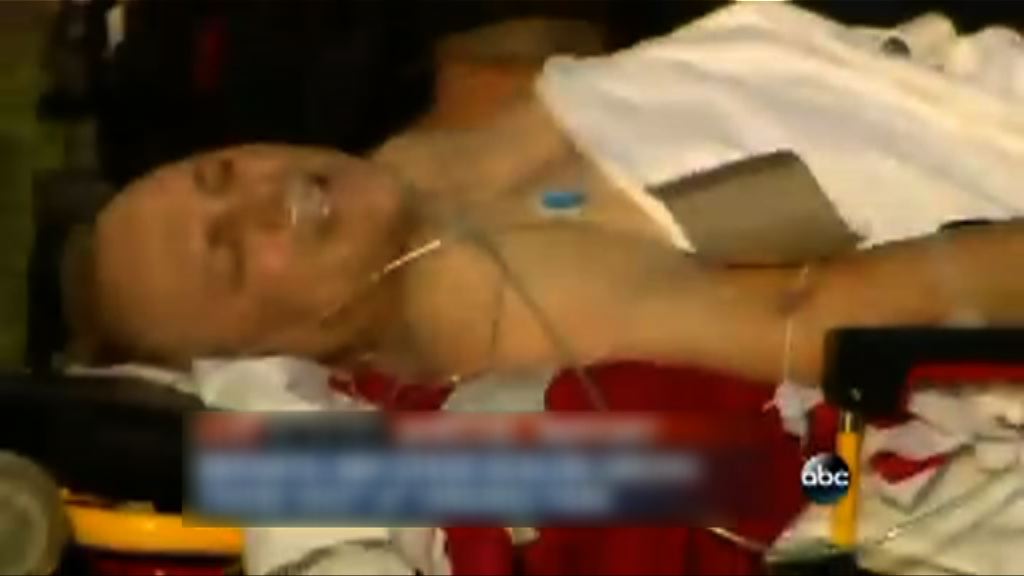 聯邦調查局接手調查美國眾議員中槍事件