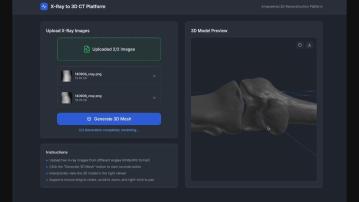 科大研發新型醫學影像技術　省卻多重電腦掃描檢查減少接觸輻射